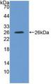 IL4R / CD124 Antibody - Western Blot; Sample: Recombinant IL4R, Rat.