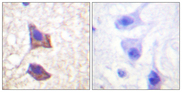 IL6ST / CD130 / gp130 Antibody - Immunohistochemistry analysis of paraffin-embedded human brain tissue, using CD130/gp130 Antibody. The picture on the right is blocked with the synthesized peptide.
