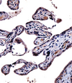 IL9R / CD129 Antibody - IL9R Antibody immunohistochemistry of formalin-fixed and paraffin-embedded human placenta tissue followed by peroxidase-conjugated secondary antibody and DAB staining.