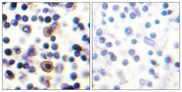 IL9R / CD129 Antibody - Immunohistochemistry analysis of paraffin-embedded human lymph node, using IL-9R (Phospho-Ser519) Antibody. The picture on the right is blocked with the phospho peptide.