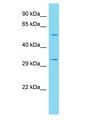 ILDR2 Antibody - ILDR2 antibody Western Blot of 721_B. Antibody dilution: 1 ug/ml.  This image was taken for the unconjugated form of this product. Other forms have not been tested.