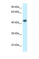 ILKAP Antibody - ILKAP antibody Western blot of 721_B Cell lysate. Antibody concentration 1 ug/ml.  This image was taken for the unconjugated form of this product. Other forms have not been tested.