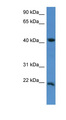 IMMP2L Antibody - IMMP2L antibody Western blot of Fetal Lung lysate.  This image was taken for the unconjugated form of this product. Other forms have not been tested.