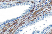 Prostate: Desmin (m), VECTASTAIN® Universal Quick Kit, ImmPACT™ DAB (brown) substrate. Hematoxylin QS (blue) counterstain.