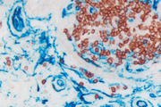 Colon (double label): Anti-CD3 (rabbit monoclonal), ImmPRESS™ (Peroxidase) Anti-Rabbit Ig, ImmPACT™ AMEC Red. Anti CD34 (mouse monoclonal), ImmPRESS-AP Anti-mouse Ig, Vector Blue™ (blue).