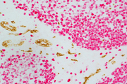 Tonsil (paraffin): ImmPRESS™ Duet Kit (LS-J1072) used to detect mouse anti- CD34 (ImmPACT™ DAB, brown) and rabbit anti-Ki67 (ImmPACT™ Vector® Red, magenta) antibodies.