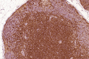 Rhesus macaque formalin/paraffin lymph node: CD4 (1F6), ImmPRESS™ Anti-Mouse Ig Kit, ImmPACT™ DAB substrate (brown). Hematoxylin counterstain (blue). Courtesy of Charles Brown, NIH, NIAID, Laboratory of Molecular Microbiology.
