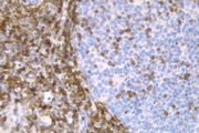 Tonsil: Bcl-2 (m), ImmPRESS™ Anti-Mouse Ig Kit, DAB Substrate Kit (brown). Hematoxylin QS counterstain (blue).