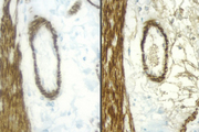 Sections of rat intestine stained with a mouse antibody to Desmin and detected with a rat adsorbed or non-rat adsorbed ImmPRESS™ Anti-Mouse Ig Kit: ImmPRESS™ Anti-Mouse Ig Kit (Rat Adsorbed), left, ImmPRESS™ Anti-Mouse Ig (non-rat adsorbed), right; DAB (brown).