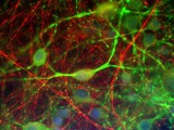 INA / Alpha Internexin Antibody - Mixed cultures of rat CNS cells stained with INA / Alpha Internexin antibody (red) and chicken antibody to Microtubule associated protein 2 (MAP2- green). The a</span>-internexin is localized primarily in neuronal axons in these cultures, while the perikarya and dendrites of neurons stain strongly for MAP2.