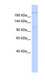 INADL / PATJ Antibody - INADL antibody Western blot of 293T cell lysate. This image was taken for the unconjugated form of this product. Other forms have not been tested.
