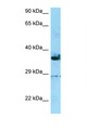 INF2 Antibody - INF2 antibody Western blot of HepG2 Cell lysate. Antibody concentration 1 ug/ml.  This image was taken for the unconjugated form of this product. Other forms have not been tested.