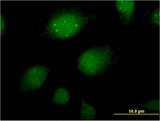 ING2 Antibody - Immunofluorescence of monoclonal antibody to ING2 on HeLa cell . [antibody concentration 10 ug/ml]