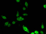 ING5 Antibody - Immunofluorescent analysis of Hela cells using ING5 Antibody at a dilution of 1:100 and Alexa Fluor 488-congugated AffiniPure Goat Anti-Rabbit IgG(H+L)