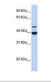 INHA / Inhibin Alpha Antibody - Fetal liver lysate. Antibody concentration: 1.0 ug/ml. Gel concentration: 12%.  This image was taken for the unconjugated form of this product. Other forms have not been tested.