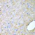 INHA / Inhibin Alpha Antibody - Immunohistochemistry of paraffin-embedded rat brain using INHA antibodyat dilution of 1:200 (40x lens).