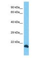 INO80C Antibody - INO80C antibody Western Blot of PANC1. Antibody dilution: 1 ug/ml.  This image was taken for the unconjugated form of this product. Other forms have not been tested.