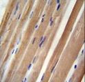 INPP5B Antibody - INPP5B antibody immunohistochemistry of formalin-fixed and paraffin-embedded human skeletal muscle followed by peroxidase-conjugated secondary antibody and DAB staining.
