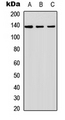 INPPL1 / SHIP2 Antibody - Western blot analysis of SHIP2 expression in A549 (A); NS-1 (B); PC12 (C) whole cell lysates.