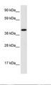INSM1 Antibody - Fetal Cerebellum Lysate.  This image was taken for the unconjugated form of this product. Other forms have not been tested.