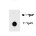 INSR / Insulin Receptor Antibody - Dot blot of anti-Phospho-INSR-pY1185 Antibody on nitrocellulose membrane. 50ng of Phospho-peptide or Non Phospho-peptide per dot were adsorbed. Antibody working concentrations are 0.5ug per ml.
