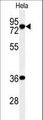 INTS10 Antibody - Western blot of INT10 Antibody in HeLa cell line lysates (35 ug/lane). INT10 (arrow) was detected using the purified antibody.