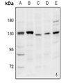 INTS2 / INT2 Antibody - Western blot analysis of INT2 expression in HepG2 (A), HCT116 (B), Hela (C), PC12 (D), CT26 (E) whole cell lysates.