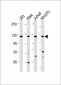 INTS3 Antibody - All lanes: Anti-INTS3 Antibody (Center) at 1:2000 dilution Lane 1: 293 whole cell lysate Lane 2: Hela whole cell lysate Lane 3: Jurkat whole cell lysate Lane 4: NIH/3T3 whole cell lysate Lysates/proteins at 20 µg per lane. Secondary Goat Anti-Rabbit IgG, (H+L), Peroxidase conjugated at 1/10000 dilution. Predicted band size: 118 kDa Blocking/Dilution buffer: 5% NFDM/TBST.