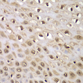 INTS5 Antibody - Immunohistochemistry of paraffin-embedded human esophageal tissue.