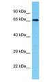 INTS9 Antibody - INTS9 antibody Western Blot of MCF7. Antibody dilution: 1 ug/ml.  This image was taken for the unconjugated form of this product. Other forms have not been tested.