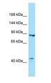 IPO8 / Importin 8 Antibody - IPO8 / Importin 8 antibody Western Blot of Fetal Kidney.  This image was taken for the unconjugated form of this product. Other forms have not been tested.