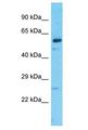 IQCC Antibody - IQCC antibody Western Blot of MCF7. Antibody dilution: 1 ug/ml.  This image was taken for the unconjugated form of this product. Other forms have not been tested.