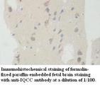 IQCC Antibody
