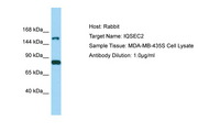 IQSEC2 Antibody -  This image was taken for the unconjugated form of this product. Other forms have not been tested.