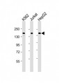 IQSEC2 Antibody - All lanes: Anti-IQSEC2 Antibody (Center) at 1:2000 dilution. Lane 1: K562 whole cell lysates. Lane 2: Jurkat whole cell lysates. Lane 3: HepG2 whole cell lysates Lysates/proteins at 20 ug per lane. Secondary Goat Anti-Rabbit IgG, (H+L), Peroxidase conjugated at 1:10000 dilution. Predicted band size: 162 kDa. Blocking/Dilution buffer: 5% NFDM/TBST.