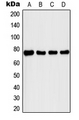IRAK1 / IRAK Antibody - Western blot analysis of IRAK1 (pT209) expression in MCF7 IL1b-treated (A); K562 (B); MCF7 (C); Raw264.7 IL1b-treated (D) whole cell lysates.