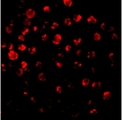 IRAK2 / IRAK-2 Antibody - Immunofluorescence of IRAK2 in HeLa cells with IRAK antibody at 10 µg/ml.