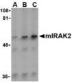 IRAK2 / IRAK-2 Antibody - Western blot of IRAK2 in A-20 whole cell lysate with anti-mIRAK2 (C2) at (A) 0.2, (B) 1, and (C) 2 ug/ml.