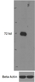IRAK3 / IRAKM / IRAK-M Antibody - Goat Anti-IRAK3 (mouse) Antibody (0.5µg/ml) staining of Mouse Bone Marrow (wildtype first lane, KO second lane) lysates (35µg protein in RIPA buffer). Primary incubation was overnight at 4C Detected with chemiluminescence. Data obtained from anonymous customer