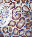 IREB2 / IRP2 Antibody - IREB2 Antibody immunohistochemistry of formalin-fixed and paraffin-embedded human kidney tissue followed by peroxidase-conjugated secondary antibody and DAB staining.