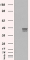 IRF2 Antibody - IRF2 antibody staining (2µg/ml) of Jurkat lysate (RIPA buffer, 30µg total protein per lane). Primary incubated for 1 hour. Detected by chemiluminescence.