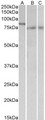 IRF2BP1 Antibody - Goat Anti-IRF2BP1 (aa461-474) Antibody (1µg/ml) staining of nuclear NIH3T3 lysate (A) and of Mouse (B) and Rat (C) Colon lysates (35µg protein in RIPA buffer). Primary incubation was 1 hour. Detected by chemiluminescencence.