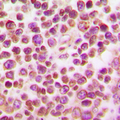 IRF4 Antibody - Immunohistochemical analysis of IRF4 staining in human tonsil formalin fixed paraffin embedded tissue section. The section was pre-treated using heat mediated antigen retrieval with sodium citrate buffer (pH 6.0). The section was then incubated with the antibody at room temperature and detected using an HRP conjugated compact polymer system. DAB was used as the chromogen. The section was then counterstained with hematoxylin and mounted with DPX.