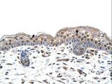 IRF4 Antibody - IRF4 antibody IRF4(interferon regulatory factor 4) Antibody was used in IHC to stain formalin-fixed, paraffin-embedded human skin.  This image was taken for the unconjugated form of this product. Other forms have not been tested.