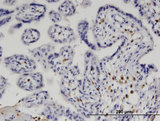 IRF5 Antibody - Immunoperoxidase of monoclonal antibody to IRF5 on formalin-fixed paraffin-embedded human placenta. [antibody concentration 1.5 ug/ml]