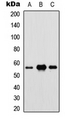 IRF5 Antibody - Western blot analysis of IRF5 expression in HEK293T (A); Raw264.7 (B); PC12 (C) whole cell lysates.