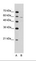 IRX4 Antibody - Jurkat Cell Lysate.  This image was taken for the unconjugated form of this product. Other forms have not been tested.