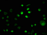 IRX4 Antibody - Immunofluorescence staining of MCF-7 cells with IRX4 Antibody at 1:100, counter-stained with DAPI. The cells were fixed in 4% formaldehyde, permeabilized using 0.2% Triton X-100 and blocked in 10% normal Goat Serum. The cells were then incubated with the antibody overnight at 4°C. The secondary antibody was Alexa Fluor 488-congugated AffiniPure Goat Anti-Rabbit IgG(H+L).
