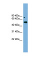 IRX5 Antibody - IRX5 antibody Western blot of NIH3T3 cell lysate. This image was taken for the unconjugated form of this product. Other forms have not been tested.