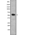 ISG54 / IFIT2 Antibody - Western blot analysis IFIT2 using HeLa whole cells lysates